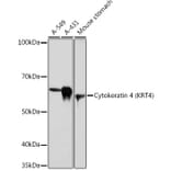 Western Blot - Anti-Cytokeratin 4 Antibody [ARC1804] (A307427) - Antibodies.com