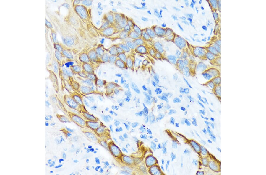 Immunohistochemistry - Anti-Cytokeratin 4 Antibody [ARC1804] (A307427) - Antibodies.com