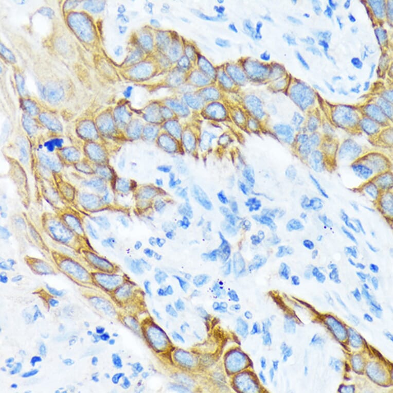 Immunohistochemistry - Anti-Cytokeratin 4 Antibody [ARC1804] (A307427) - Antibodies.com