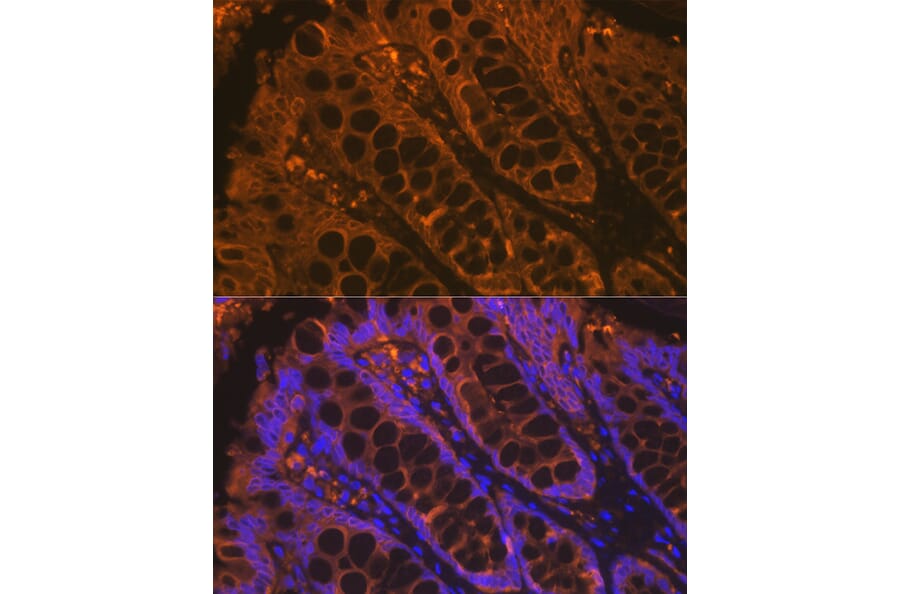 Immunofluorescence - Anti-Cytokeratin 4 Antibody [ARC1804] (A307427) - Antibodies.com