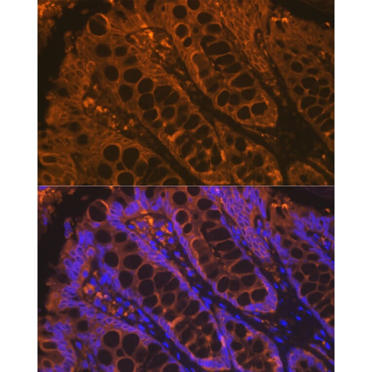 Immunofluorescence - Anti-Cytokeratin 4 Antibody [ARC1804] (A307427) - Antibodies.com