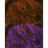 Immunofluorescence - Anti-Cytokeratin 4 Antibody [ARC1804] (A307427) - Antibodies.com
