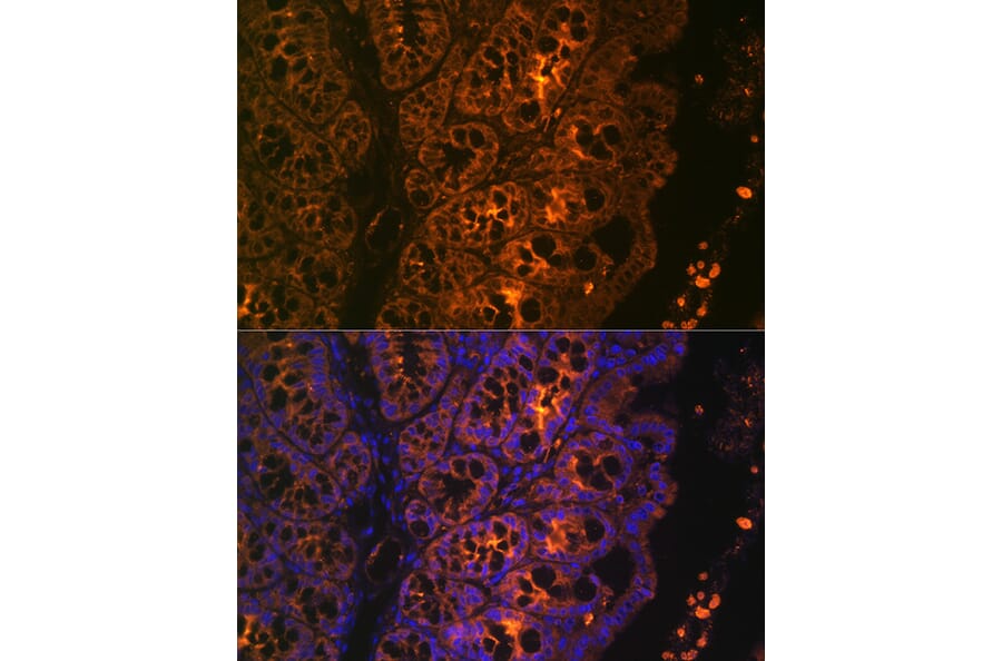 Immunofluorescence - Anti-Cytokeratin 4 Antibody [ARC1804] (A307427) - Antibodies.com