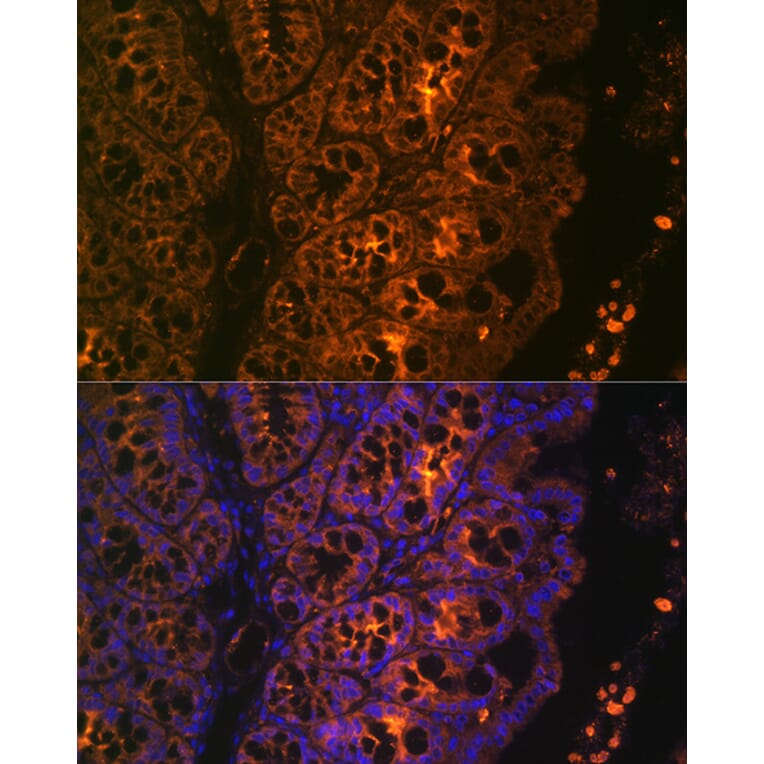 Immunofluorescence - Anti-Cytokeratin 4 Antibody [ARC1804] (A307427) - Antibodies.com