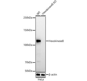 Western Blot - Anti-Hexokinase II Antibody [ARC52057] (A307428) - Antibodies.com