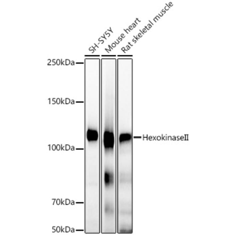 Western Blot - Anti-Hexokinase II Antibody [ARC52057] (A307428) - Antibodies.com
