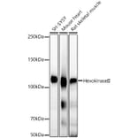 Western Blot - Anti-Hexokinase II Antibody [ARC52057] (A307428) - Antibodies.com