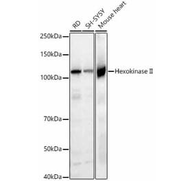 Western Blot - Anti-Hexokinase II Antibody [ARC52060] (A307429) - Antibodies.com