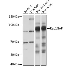 Western Blot - Anti-RAP1GAP Antibody [ARC2058] (A307431) - Antibodies.com