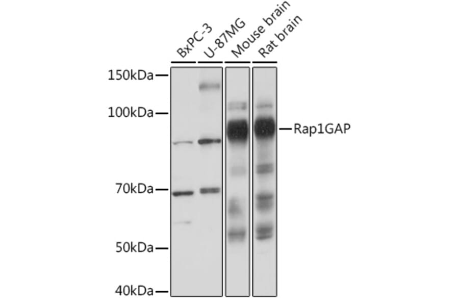 Western Blot - Anti-RAP1GAP Antibody [ARC2058] (A307431) - Antibodies.com