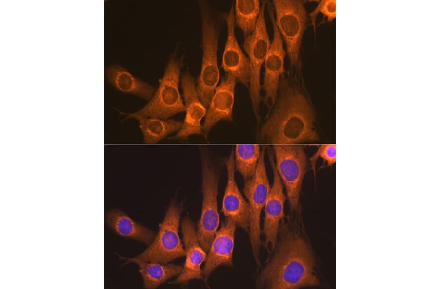 Immunofluorescence - Anti-RAP1GAP Antibody [ARC2058] (A307431) - Antibodies.com