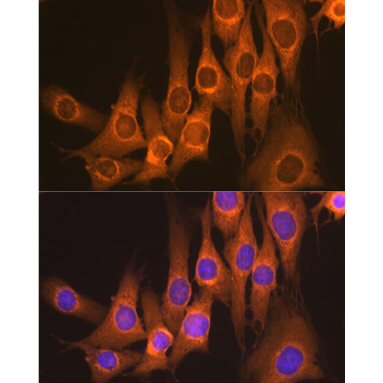 Immunofluorescence - Anti-RAP1GAP Antibody [ARC2058] (A307431) - Antibodies.com