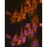 Immunofluorescence - Anti-RAP1GAP Antibody [ARC2058] (A307431) - Antibodies.com