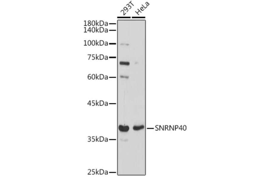 Western Blot - Anti-SNRNP40 Antibody (A307432) - Antibodies.com