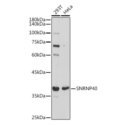 Western Blot - Anti-SNRNP40 Antibody (A307432) - Antibodies.com
