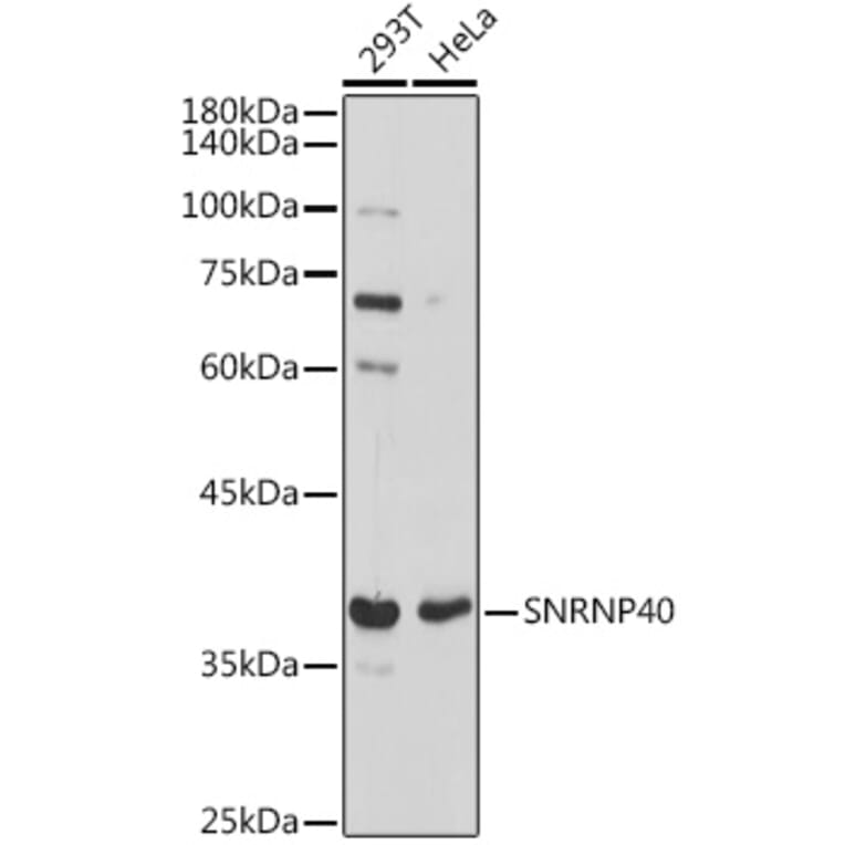 Western Blot - Anti-SNRNP40 Antibody (A307432) - Antibodies.com