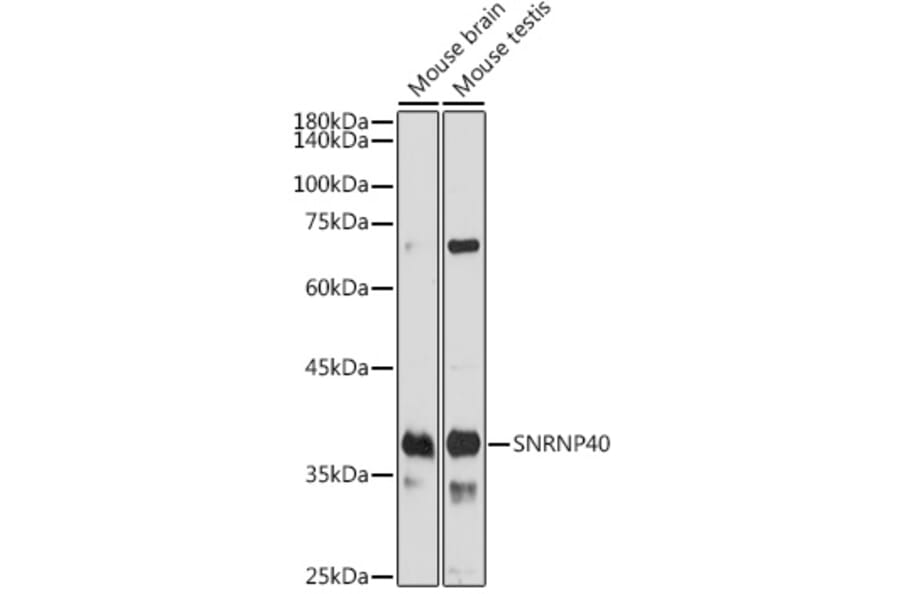 Western Blot - Anti-SNRNP40 Antibody (A307432) - Antibodies.com