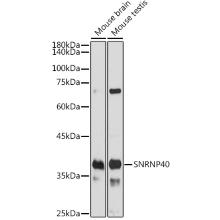 Western Blot - Anti-SNRNP40 Antibody (A307432) - Antibodies.com