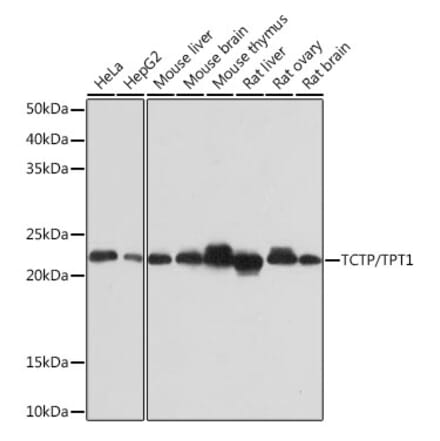 Western Blot - Anti-TCTP Antibody [ARC0743] (A307435) - Antibodies.com