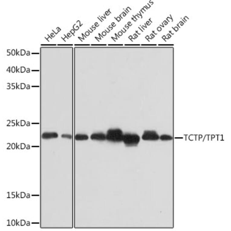 Western Blot - Anti-TCTP Antibody [ARC0743] (A307435) - Antibodies.com