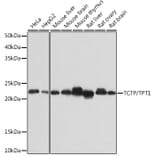 Western Blot - Anti-TCTP Antibody [ARC0743] (A307435) - Antibodies.com