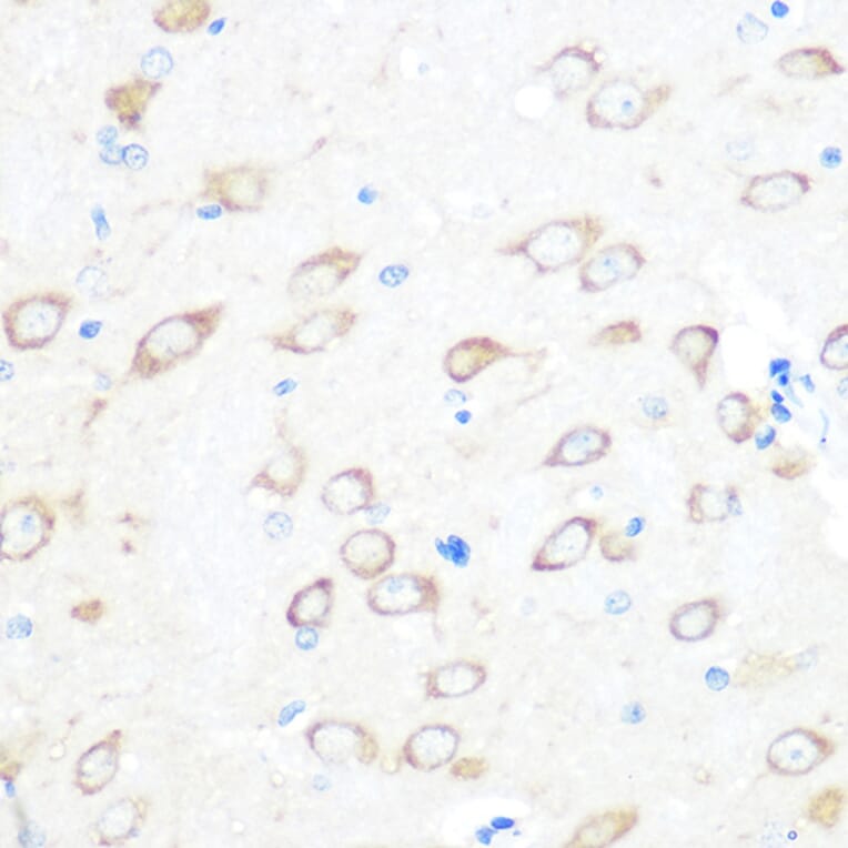 Immunohistochemistry - Anti-TCTP Antibody [ARC0743] (A307435) - Antibodies.com