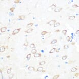 Immunohistochemistry - Anti-TCTP Antibody [ARC0743] (A307435) - Antibodies.com
