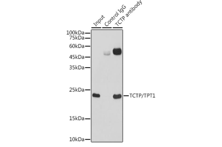 Western Blot - Anti-TCTP Antibody [ARC0743] (A307435) - Antibodies.com