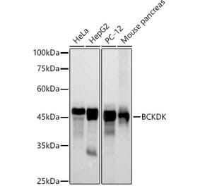 Western Blot - Anti-BCKDK Antibody [ARC2875] (A307436) - Antibodies.com