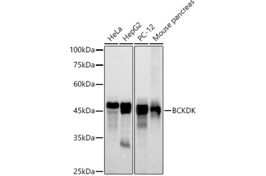 Western Blot - Anti-BCKDK Antibody [ARC2875] (A307436) - Antibodies.com