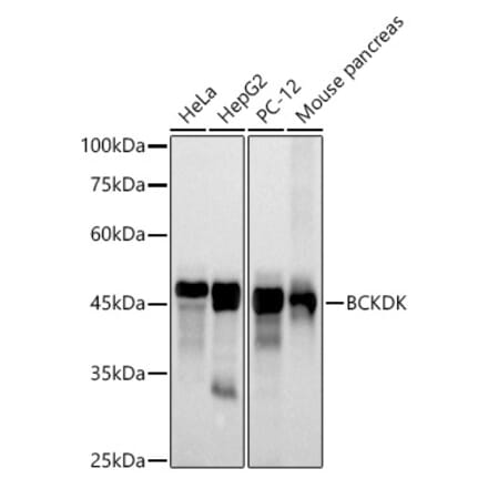 Western Blot - Anti-BCKDK Antibody [ARC2875] (A307436) - Antibodies.com