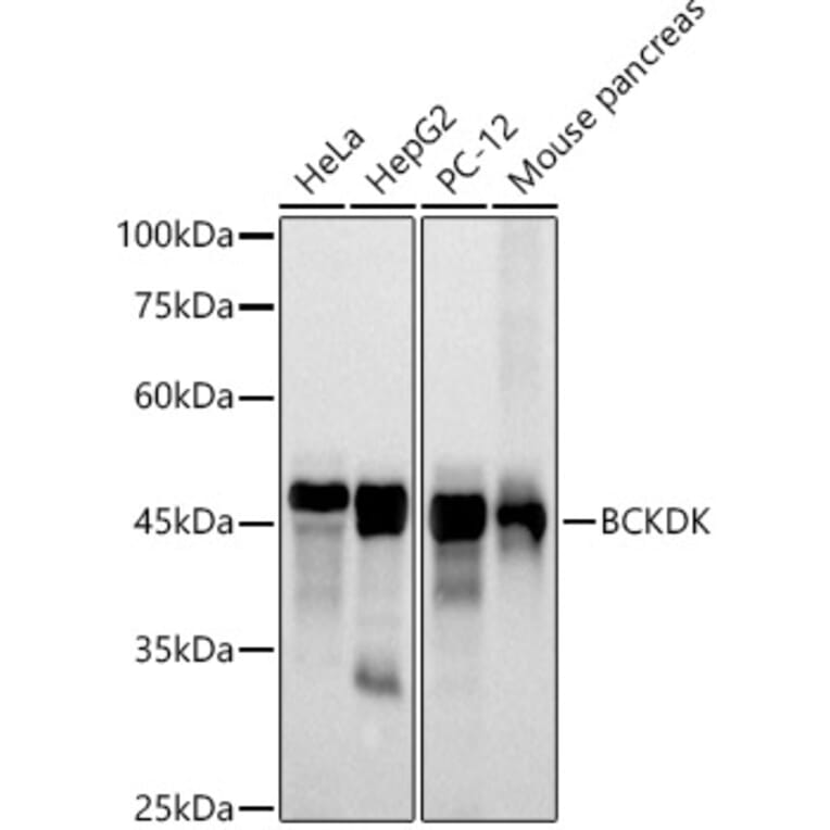 Western Blot - Anti-BCKDK Antibody [ARC2875] (A307436) - Antibodies.com
