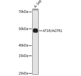 Western Blot - Anti-Angiotensin II Type 1 Receptor Antibody [ARC0905] (A307437) - Antibodies.com