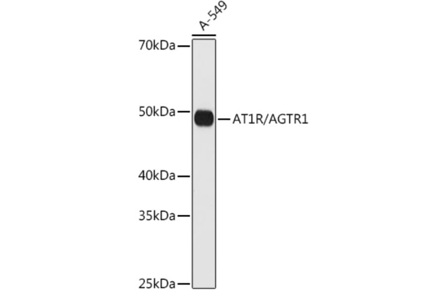 Western Blot - Anti-Angiotensin II Type 1 Receptor Antibody [ARC0905] (A307437) - Antibodies.com