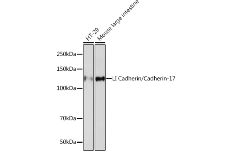 Western Blot - Anti-LI Cadherin Antibody [ARC1989] (A307438) - Antibodies.com
