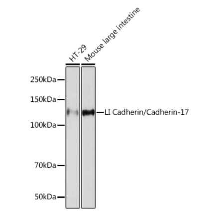 Western Blot - Anti-LI Cadherin Antibody [ARC1989] (A307438) - Antibodies.com