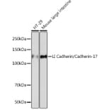 Western Blot - Anti-LI Cadherin Antibody [ARC1989] (A307438) - Antibodies.com