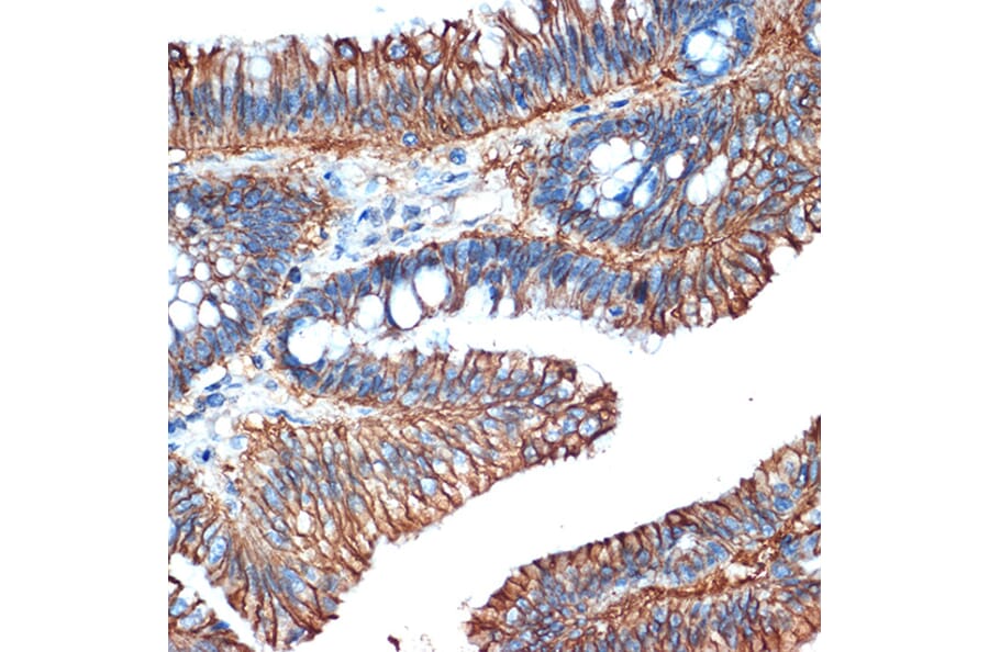 Immunohistochemistry - Anti-LI Cadherin Antibody [ARC1989] (A307438) - Antibodies.com