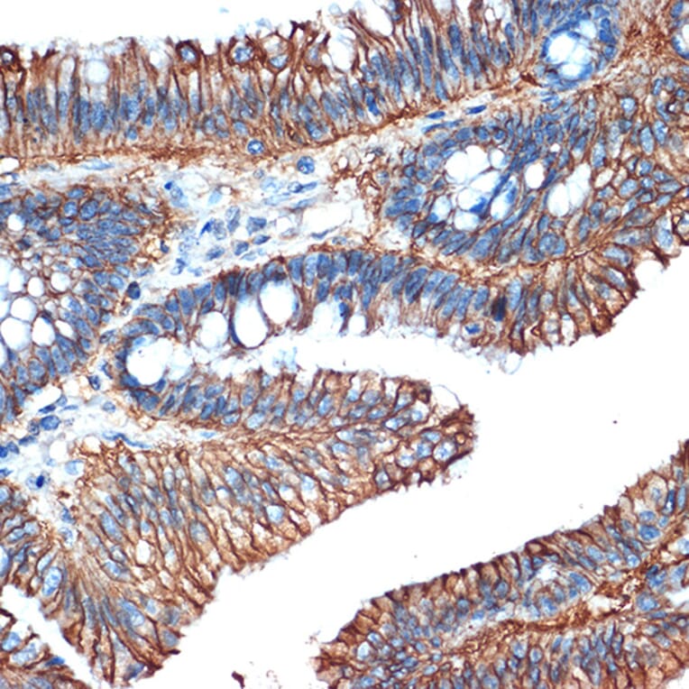 Immunohistochemistry - Anti-LI Cadherin Antibody [ARC1989] (A307438) - Antibodies.com