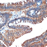 Immunohistochemistry - Anti-LI Cadherin Antibody [ARC1989] (A307438) - Antibodies.com