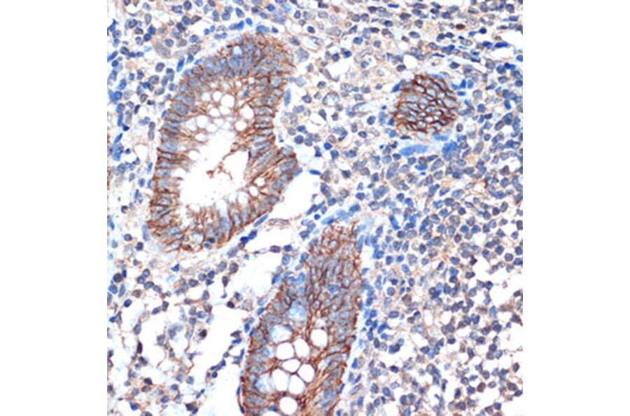 Immunohistochemistry - Anti-LI Cadherin Antibody [ARC1989] (A307438) - Antibodies.com