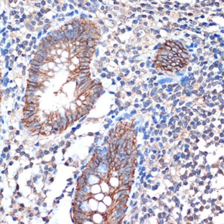 Immunohistochemistry - Anti-LI Cadherin Antibody [ARC1989] (A307438) - Antibodies.com