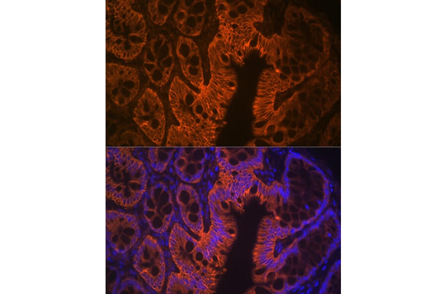 Immunofluorescence - Anti-LI Cadherin Antibody [ARC1989] (A307438) - Antibodies.com