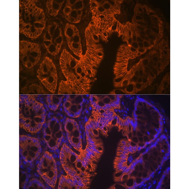Immunofluorescence - Anti-LI Cadherin Antibody [ARC1989] (A307438) - Antibodies.com