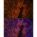 Immunofluorescence - Anti-LI Cadherin Antibody [ARC1989] (A307438) - Antibodies.com