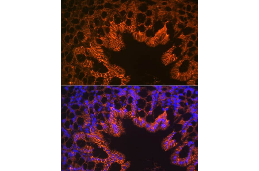 Immunofluorescence - Anti-LI Cadherin Antibody [ARC1989] (A307438) - Antibodies.com