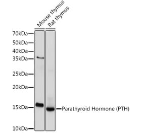 Western Blot - Anti-Parathyroid Hormone Antibody [ARC1709] (A307439) - Antibodies.com