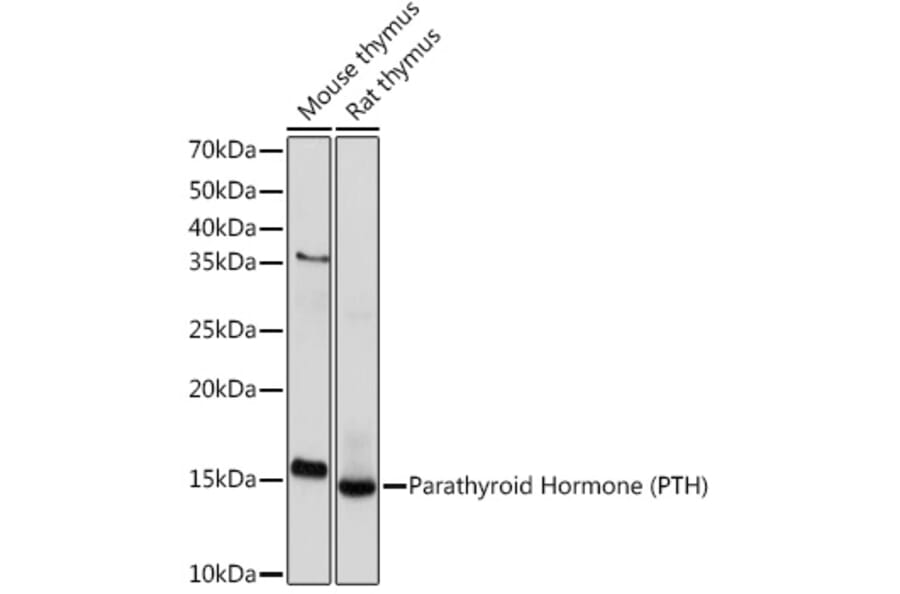 Western Blot - Anti-Parathyroid Hormone Antibody [ARC1709] (A307439) - Antibodies.com