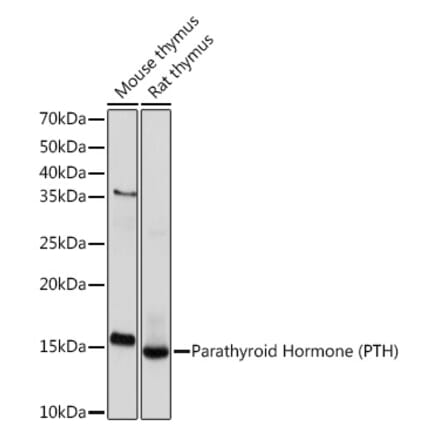 Western Blot - Anti-Parathyroid Hormone Antibody [ARC1709] (A307439) - Antibodies.com