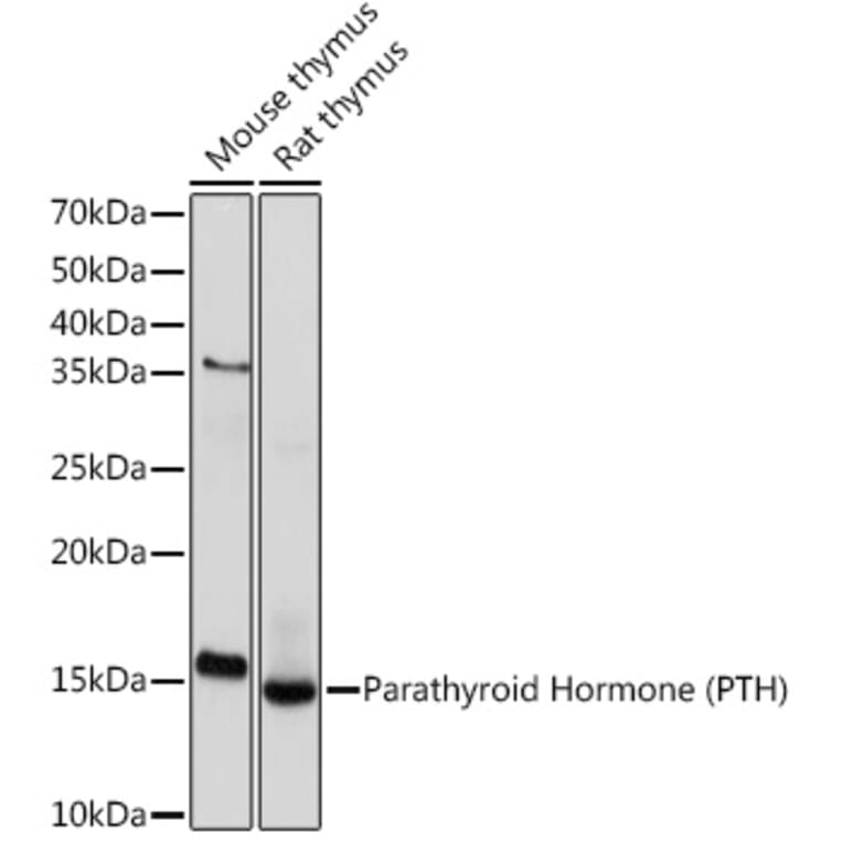 Western Blot - Anti-Parathyroid Hormone Antibody [ARC1709] (A307439) - Antibodies.com